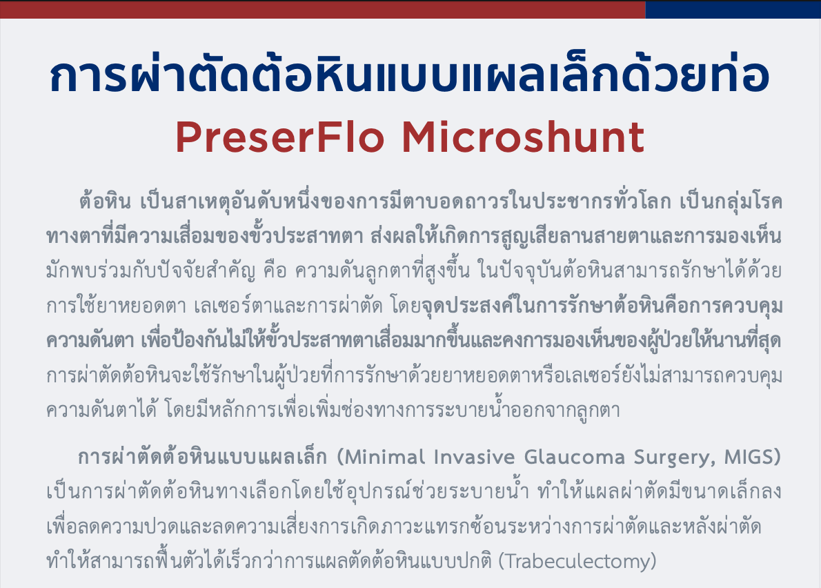 การผ่าตัดต้อหินแบบแผลเล็กด้วยท่อ